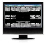 Preventive Dentistry - Dexis Digital X-rays